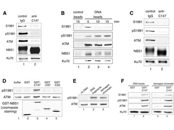 Western Blot using ATM S1981